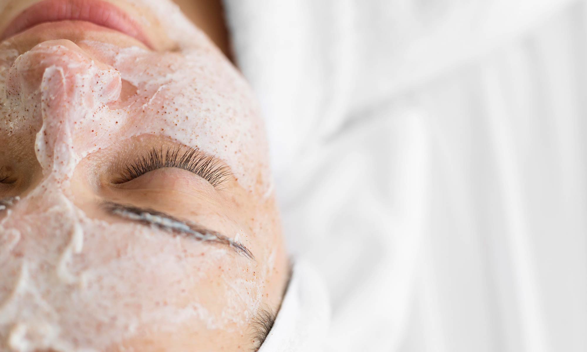 limpieza-facial-profunda-malaga